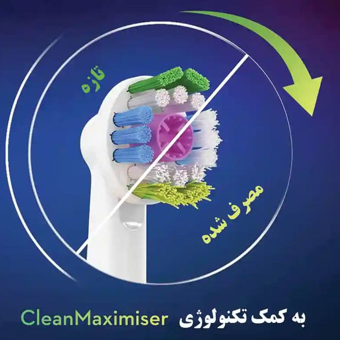 زمان تعویض سری مسواک